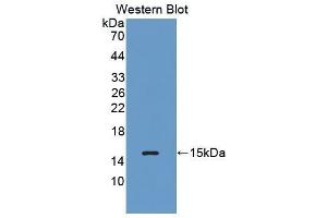Western Blotting (WB) image for anti-Complement Factor B (CFB) (AA 476-592) antibody (ABIN1858374) (Complement Factor B antibody  (AA 476-592))