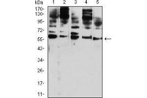 Western Blotting (WB) image for anti-CD209 (CD209) (AA 270-404) antibody (ABIN5611274)