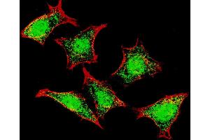 Fluorescent confocal image of HeLa cells stained with Natriuretic Peptide Receptor C (N-term) antibody. (NPR3 antibody  (N-Term))