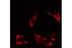 ABIN6275027 staining HuvEc cells by IF/ICC. (CEP95 antibody  (Internal Region))