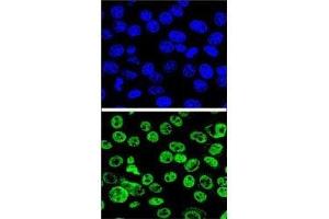 Confocal immunofluorescent analysis of MDM2 antibody with HeLa cells followed by Alexa Fluor 488-conjugated goat anti-rabbit lgG (green). (MDM2 antibody  (AA 141-176))