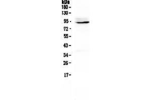 Western blot analysis of PTPN22 using anti-PTPN22 antibody . (PTPN22 antibody  (AA 1-309))