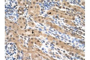EIF3M antibody was used for immunohistochemistry at a concentration of 4-8 ug/ml to stain Epithelial cells of renal tubule (arrows) in Human Kidney.