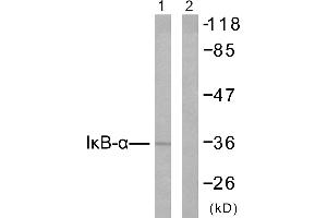 Western blot analysis of extracts from 293 cells untreated or treated with TNF-α (20ng/ml, 30min), using IκB-α (Ab-42) antibody (#B7116). (NFKBIA antibody  (Tyr42))