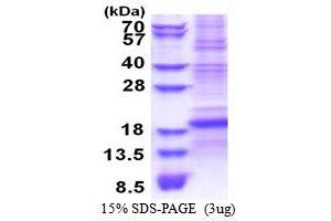 SDS-PAGE (SDS) image for CD8b Molecule (CD8B) (AA 22-170) protein (His tag) (ABIN5853494)