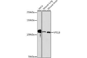 Western blot analysis of extracts of various cell lines, using VPS18 Rabbit mAb (ABIN7271274) at 1:1000 dilution. (VPS18 antibody)