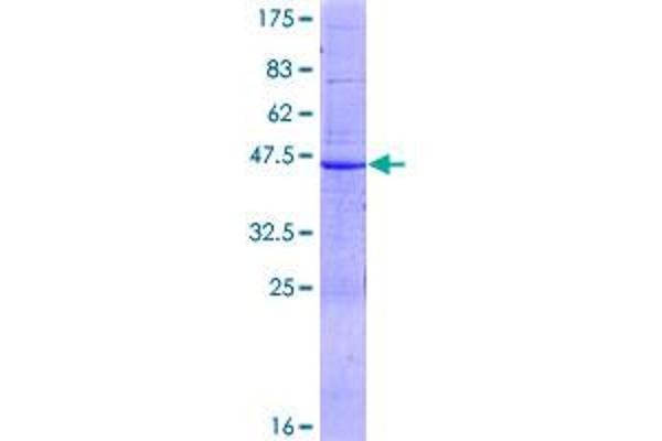 ABCA6 Protein (AA 1-185) (GST tag)