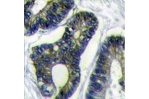 Image no. 3 for anti-Finkel-Biskis-Reilly Murine Sarcoma Virus (FBR-MuSV) Ubiquitously Expressed (FAU) (C-Term) antibody (ABIN357136) (FAU antibody  (C-Term))