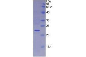 SDS-PAGE analysis of Mouse TIMP4 Protein. (TIMP4 Protein)