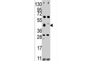 Western blot analysis of FDFT1 polyclonal antibody  in A-375 cell line lysate . (FDFT1 antibody  (Internal Region))