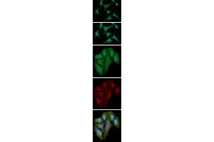 ICC/IF analysis of S100A4 in A549 cells line, stained with DAPI (Blue) for nucleus staining and monoclonal anti-human S100A4 antibody (1:100) with goat anti-mouse IgG-Alexa fluor 488 conjugate (Green). (s100a4 antibody  (AA 1-101))