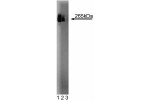 Western blot analysis of Fatty Acid Synthase on HepG2 cell lysate. (Fatty Acid Synthase antibody  (AA 9-202))