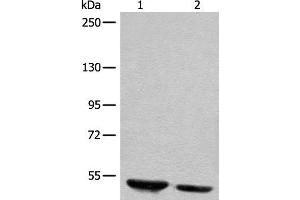 Western blot analysis of Human fetal brain tissue and mouse brain tissue lysates using DENND1B Polyclonal Antibody at dilution of 1:400 (DENND1B antibody)
