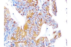 Immunohistochemistry (IHC) image for anti-Proliferation-Associated 2G4, 38kDa (PA2G4) antibody (ABIN7269550)