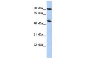 Image no. 1 for anti-Methyl CpG Binding Protein 2 (MECP2) (AA 35-84) antibody (ABIN6742304)