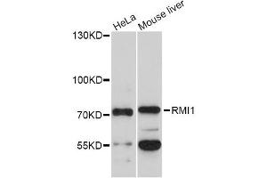 Western blot analysis of extracts of various cell lines, using RMI1 Antibody (ABIN1874612) at 1:1000 dilution. (RMI1 antibody)