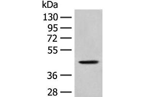 Western blot analysis of A549 cell lysate using HLA-B Polyclonal Antibody at dilution of 1:400 (HLA-B antibody)