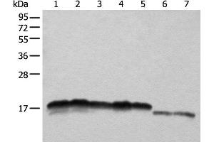 Western blot analysis of Hela HEPG2 A431 K562 and 231 cell Mouse liver tissue and Mouse brain tissue lysates using NDUFB11 Polyclonal Antibody at dilution of 1:1000 (NDUFB11 antibody)