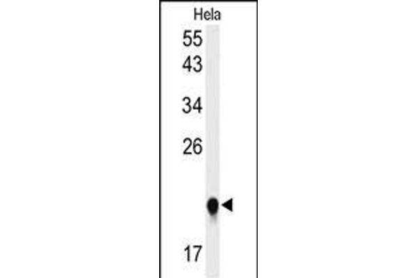 IMP3 antibody  (C-Term)