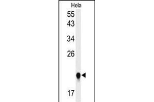Western blot analysis of I Antibody (C-term)&65288,Cat(ABIN653856 and ABIN2843116)) in Hela cell line lysates (35 μg/lane). (IMP3 antibody  (C-Term))