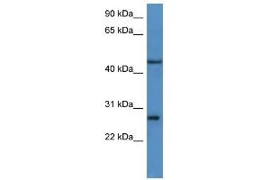 Western Blot showing FGFBP2 antibody used at a concentration of 1-2 ug/ml to detect its target protein. (FGFBP2 antibody  (C-Term))