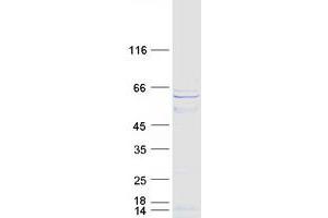 Validation with Western Blot (CPSF7 Protein (Transcript Variant 1) (Myc-DYKDDDDK Tag))