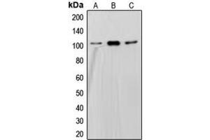 Western blot analysis of SND1 expression in HepG2 (A), Jurkat (B), Ramos (C) whole cell lysates. (SND1 antibody  (Center))