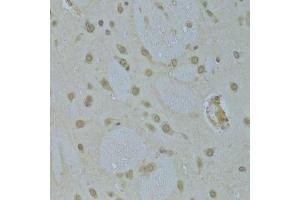 Immunohistochemistry (Paraffin-embedded Sections) (IHC (p)) image for anti-Heterogeneous Nuclear Ribonucleoprotein K (HNRNPK) (AA 1-280) antibody (ABIN3022414)