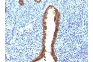 IHC testing of FFPE human uterus with ASRGL1 antibody (clone CRASH/1289). (ASRGL1 antibody)