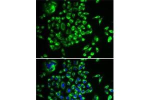 Immunofluorescence analysis of U2OS cells using MRPL28 Polyclonal Antibody (MRPL28 antibody)