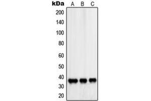 Western blot analysis of PDLIM1 expression in HeLa (A), Saos2 (B), NIH3T3 (C) whole cell lysates. (PDLIM1 antibody  (Center))
