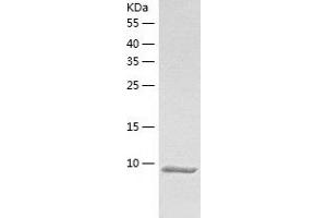 Western Blotting (WB) image for Calcium/calmodulin-Dependent Protein Kinase II Inhibitor 1 (CAMK2N1) (AA 1-78) protein (His tag) (ABIN7287681) (CAMK2N1 Protein (AA 1-78) (His tag))