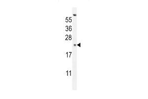 GAGE13 Antibody (N-term) (ABIN654525 and ABIN2844247) western blot analysis in K562 cell line lysates (35 μg/lane). (G Antigen 13 antibody  (N-Term))