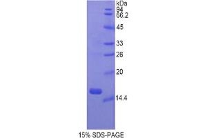 SDS-PAGE analysis of Rat Gastrokine 1 Protein.