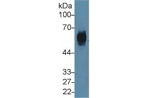 Detection of CK5 in Mouse Skin lysate using Polyclonal Antibody to Cytokeratin 5 (CK5) (Cytokeratin 5 antibody  (AA 163-471))