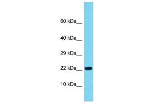 Host: Rabbit Target Name: SAPCD1 Sample Type: Fetal Kidney lysates Antibody Dilution: 1. (SAPCD1 antibody  (C-Term))