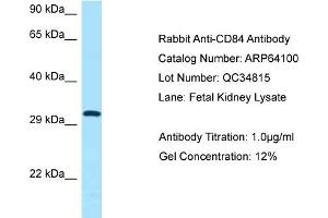 Western Blotting (WB) image for anti-CD84 (CD84) (C-Term) antibody (ABIN2789730)