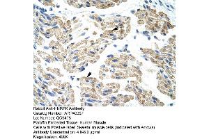 Rabbit Anti-HNRPK Antibody  Paraffin Embedded Tissue: Human Skeletal Muscle Cellular Data: Skeletal muscle  Antibody Concentration: 4. (HNRNPK antibody  (C-Term))