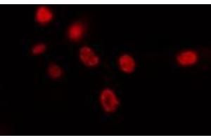 ABIN6274426 staining HepG2 cells by IF/ICC. (SPIC antibody  (Internal Region))
