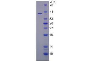 Image no. 1 for Hephaestin (HEPH) (AA 24-366) protein (His tag) (ABIN4990751) (Hephaestin Protein (HEPH) (AA 24-366) (His tag))