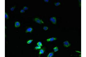 Immunofluorescent analysis of U251 cells using ABIN7163544 at dilution of 1:100 and Alexa Fluor 488-congugated AffiniPure Goat Anti-Rabbit IgG(H+L) (PLGRKT antibody  (AA 1-147))