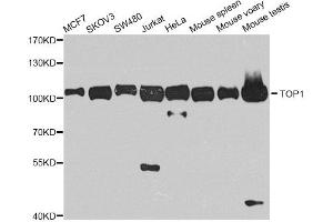 Western blot analysis of extracts of various cell lines, using TOP1 antibody. (Topoisomerase I antibody)
