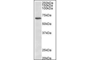 Staining of Jurkat lysate (35µg protein in RIPA buffer) using CACNB2 antibody at 1 µg/ml. (CACNB2 antibody  (C-Term))