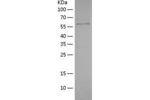 Western Blotting (WB) image for ATP-Binding Cassette, Sub-Family F (GCN20), Member 2 (ABCF2) (AA 1-218) protein (His-IF2DI Tag) (ABIN7282037) (ABCF2 Protein (AA 1-218) (His-IF2DI Tag))