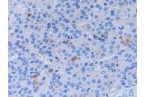 Detection of a2PI in Rat Adrenal gland Tissue using Polyclonal Antibody to Alpha 2-Antiplasmin (a2PI) (a2PI (AA 348-491) antibody)