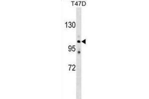 Western Blotting (WB) image for anti-ATPase, Ca++ Transporting, Type 2C, Member 1 (ATP2C1) antibody (ABIN2999252) (ATP2C1 antibody)