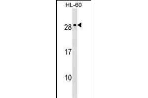 MED18 Antibody (C-term) (ABIN1536799 and ABIN2849776) western blot analysis in HL-60 cell line lysates (35 μg/lane).