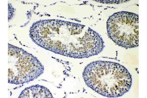 IHC analysis of CP110 using anti-CP110 antibody . (CP110 antibody  (AA 51-284))