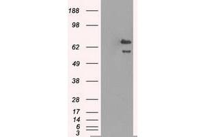 HEK293T cells were transfected with the pCMV6-ENTRY control (Left lane) or pCMV6-ENTRY HSPA9 (Right lane) cDNA for 48 hrs and lysed. (HSPA9 antibody)