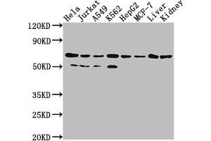 Western Blot Positive WB detected in: Hela whole cell lysate, Jurkat whole cell lysate, A549 whole cell lysate, HepG2 whole cell lysate, MCF-7 whole cell lysate, Rat liver tissue, Rat kidney tissue All lanes: AIFM1 antibody at 1:2000 Secondary Goat polyclonal to rabbit IgG at 1/50000 dilution Predicted band size: 67, 36, 29, 27 kDa Observed band size: 67 kDa (Recombinant AIF antibody)